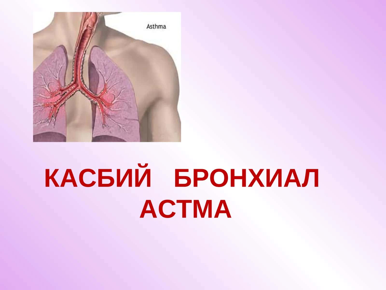 КАСБИЙ БРОНХИАЛ АСТМА 1