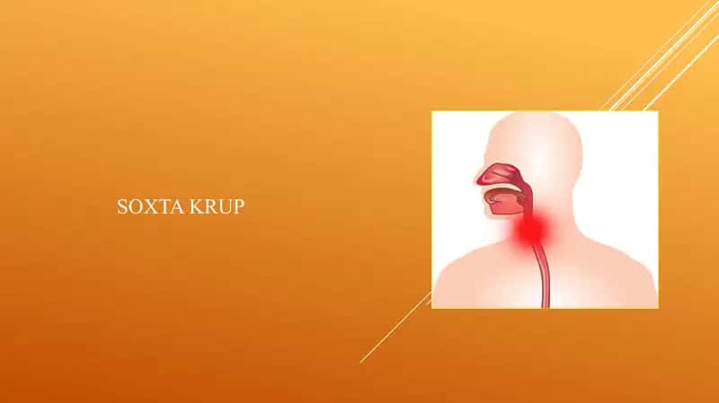 SOXTA KRUP 1