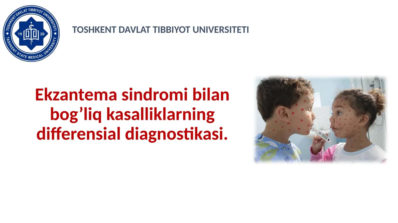 Ekzantema sindromi bilan bog’liq kasalliklarning differensial diagnostikasi 1