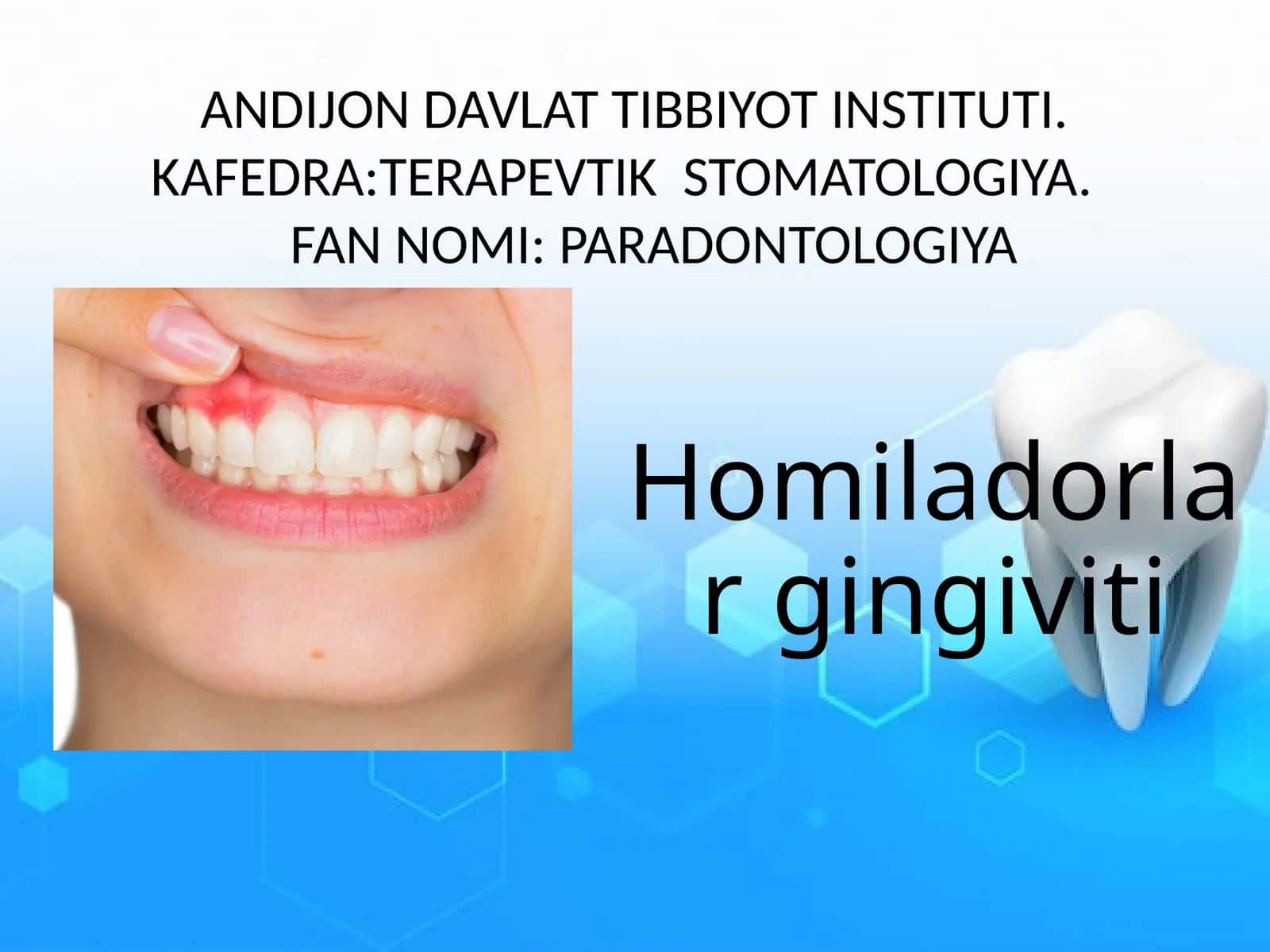 Homiladorlar gingiviti 1