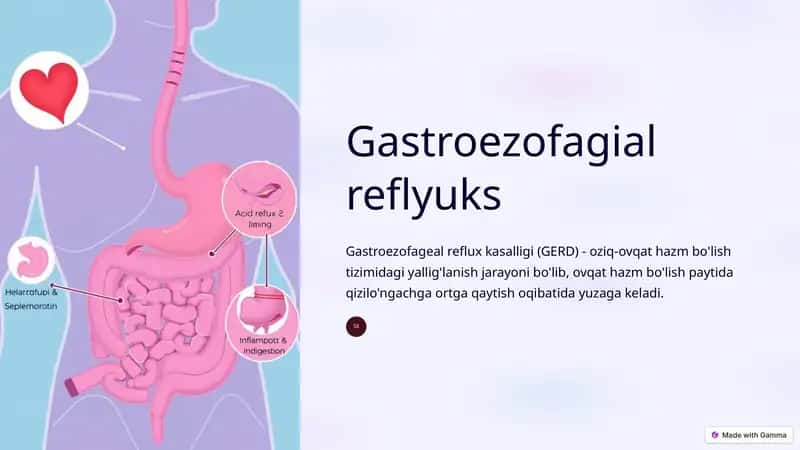 Gastroezofagial reflyuks 1