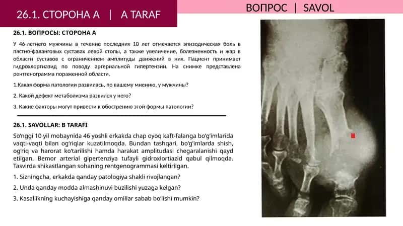 ВОПРОСЫ: СТОРОНАA 1