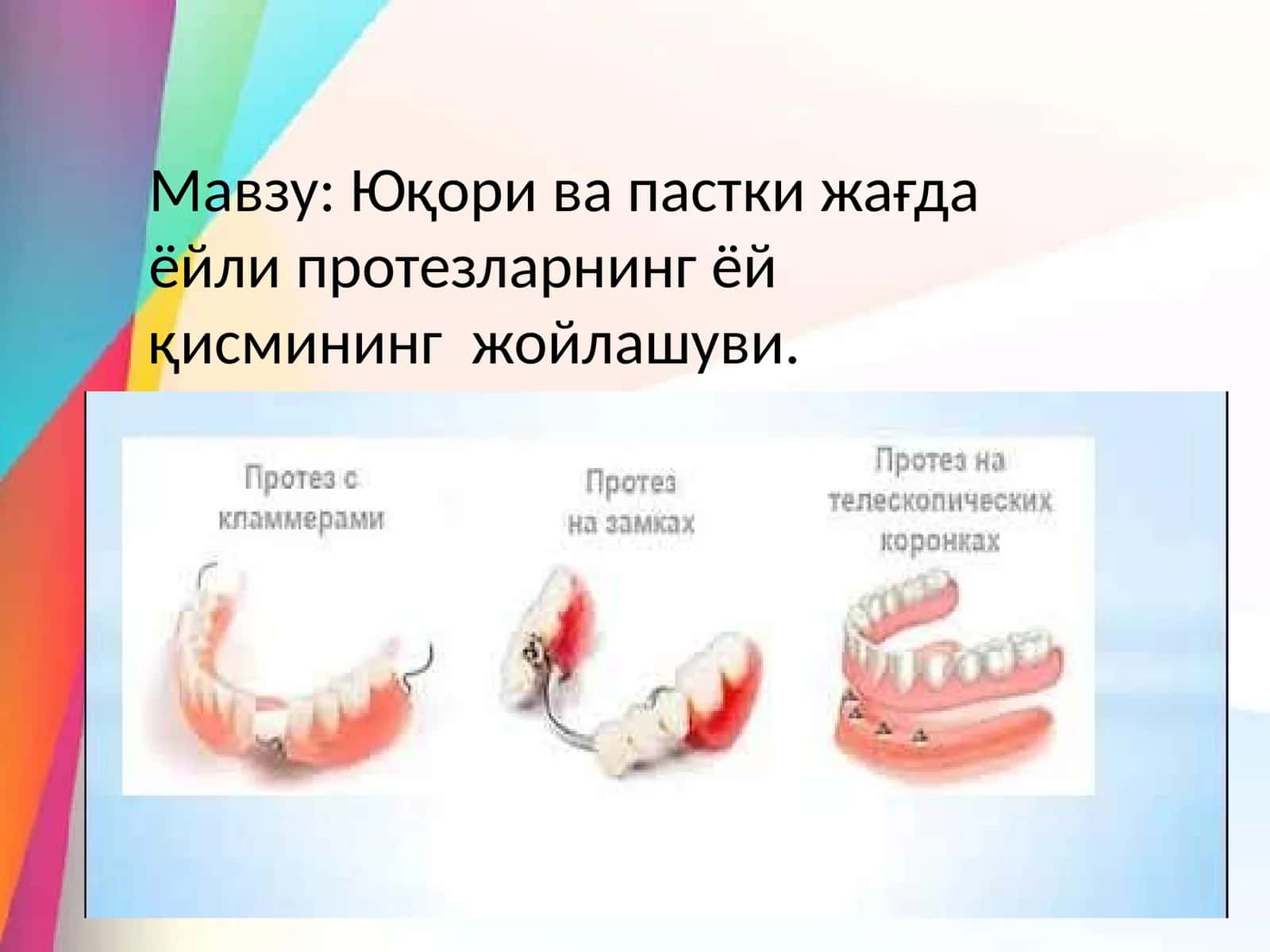Ёйли протезлар 1