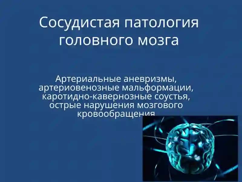 Сосудистая патология головного мозга
