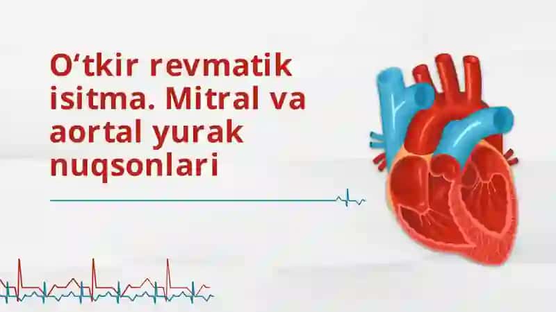 O‘tkir revmatik isitma. Mitral va aortal yurak nuqsonlari