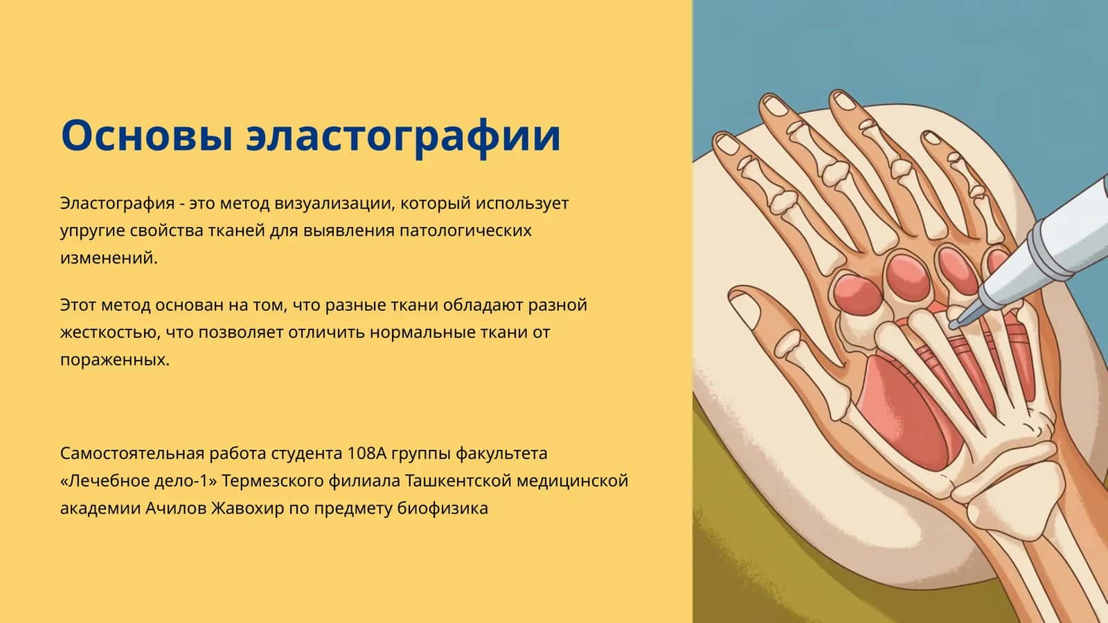 Основы эластографии 1