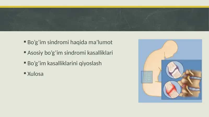 Bo'g'im sindromi haqida pptx taqdimot 1