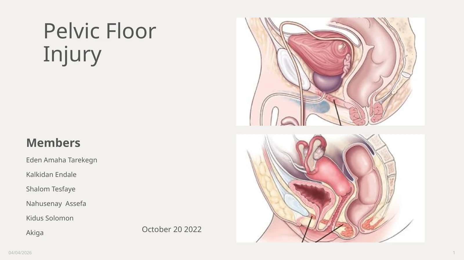 Pelvic Floor Injury 1