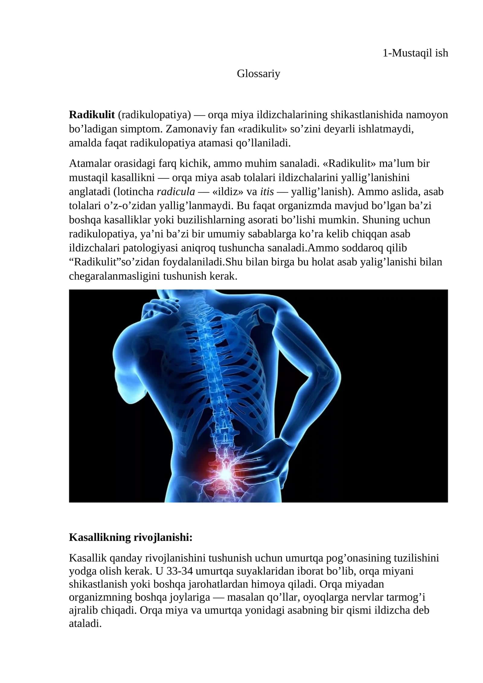 Radikulit(radikulopatiya) 1