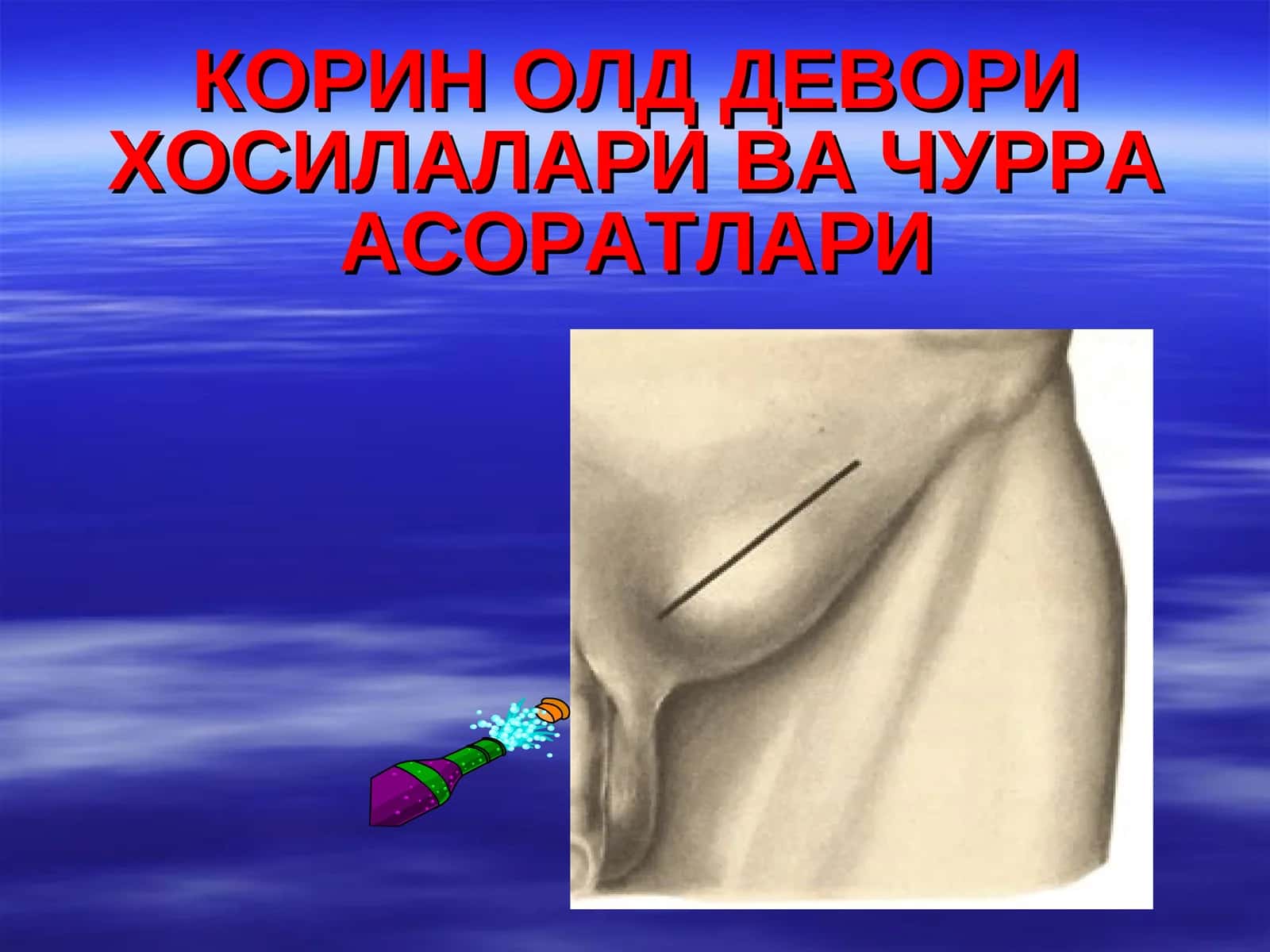 КОРИН ОЛД ДЕВОРИ ХОСИЛАЛАРИ ВА ЧУРРА АСОРАТЛАРИ 1