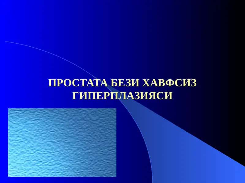 Простата бези хавфсиз гиперплазияси 1