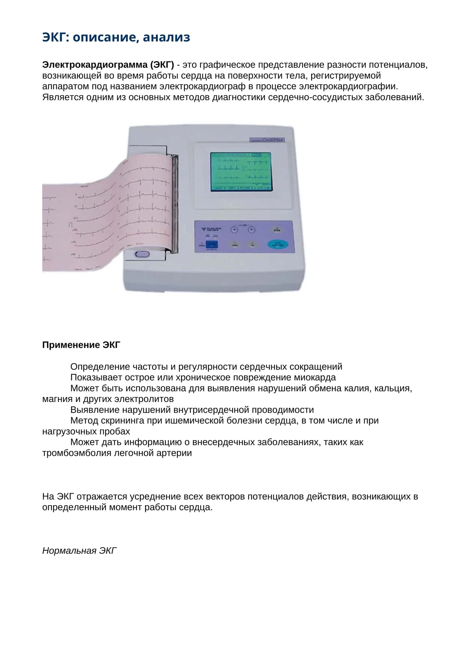 ЭКГ: описание, анализ 1