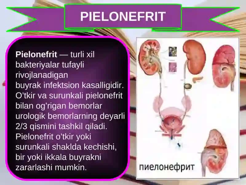 PIELONEFRIT