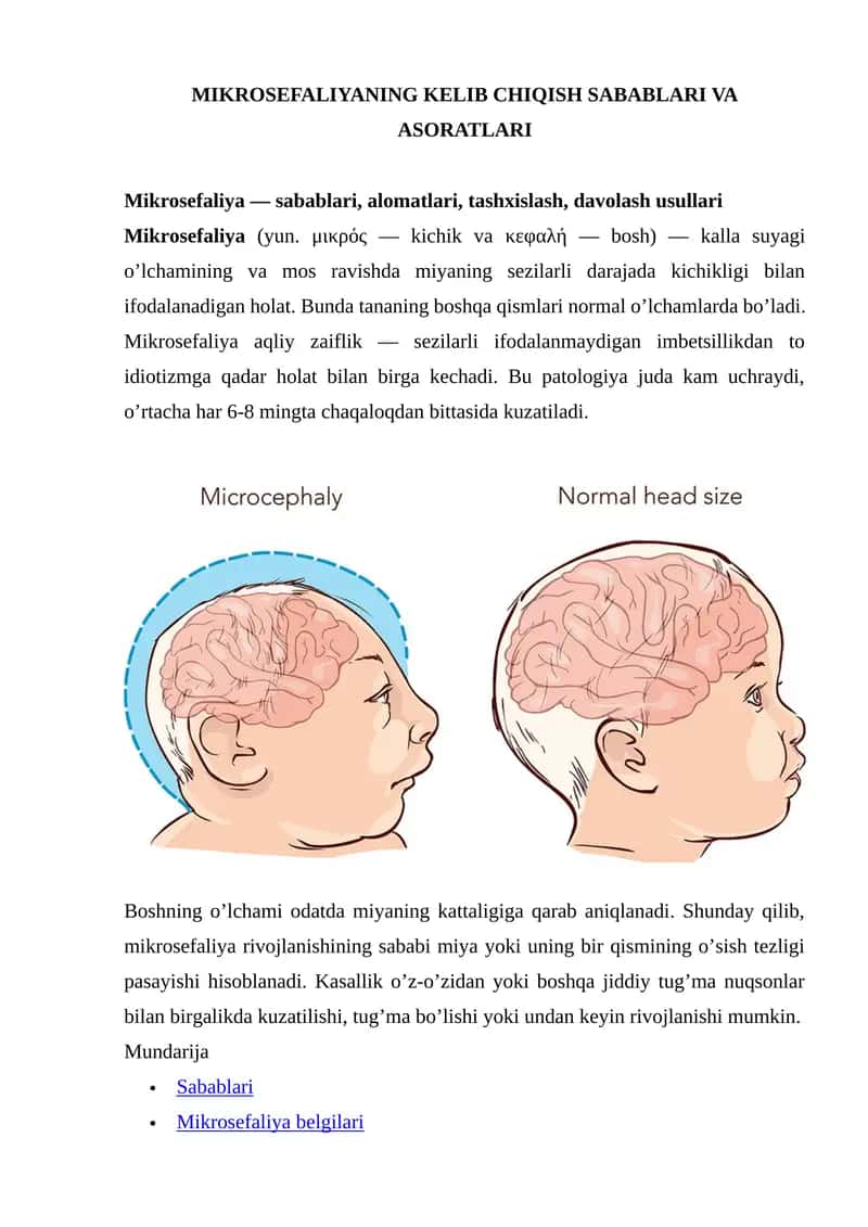 Mikrosefaliyaning Kelib Chiqish Sabablari va Asoratlari 1