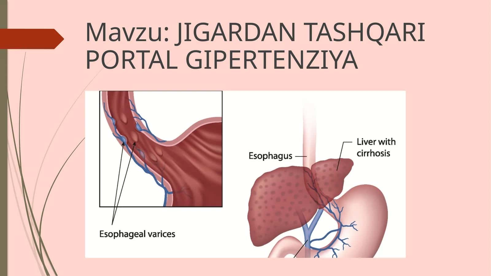 JIGARDAN TASHQARI PORTAL GIPERTENZIYA 1