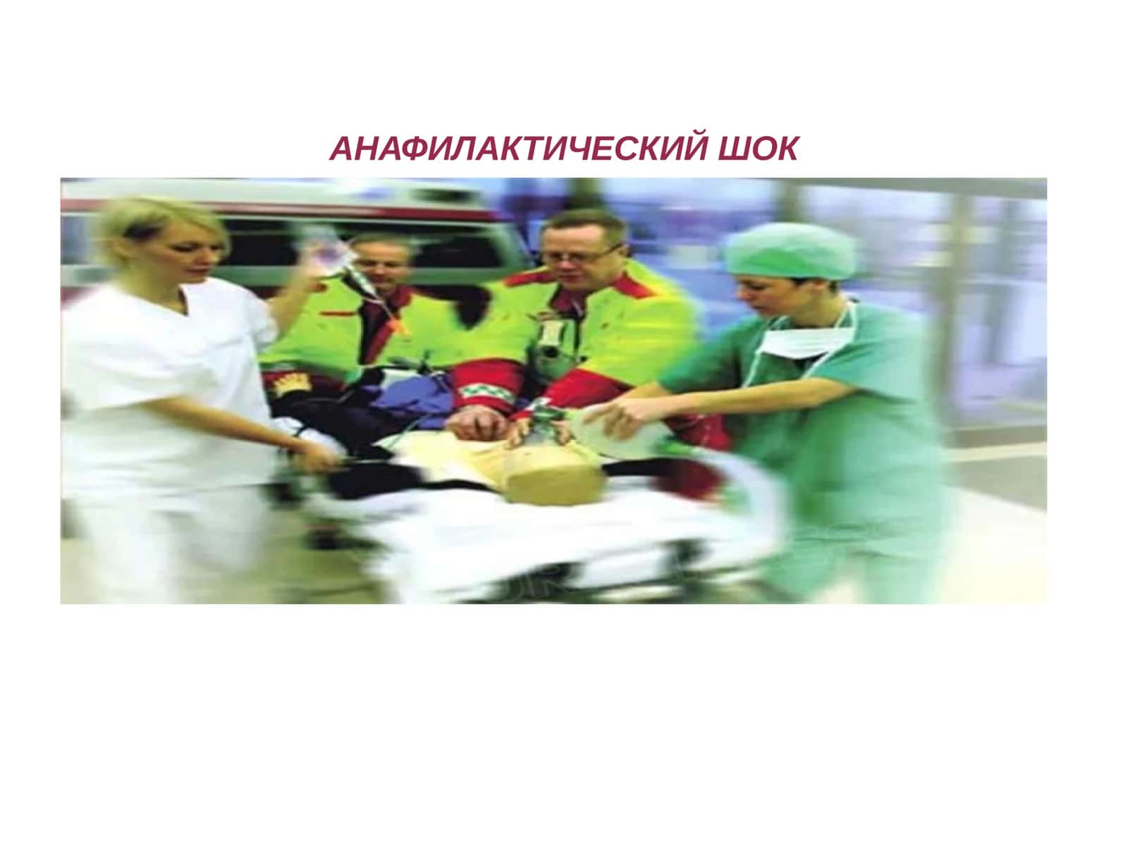 Анафилактический шок 1