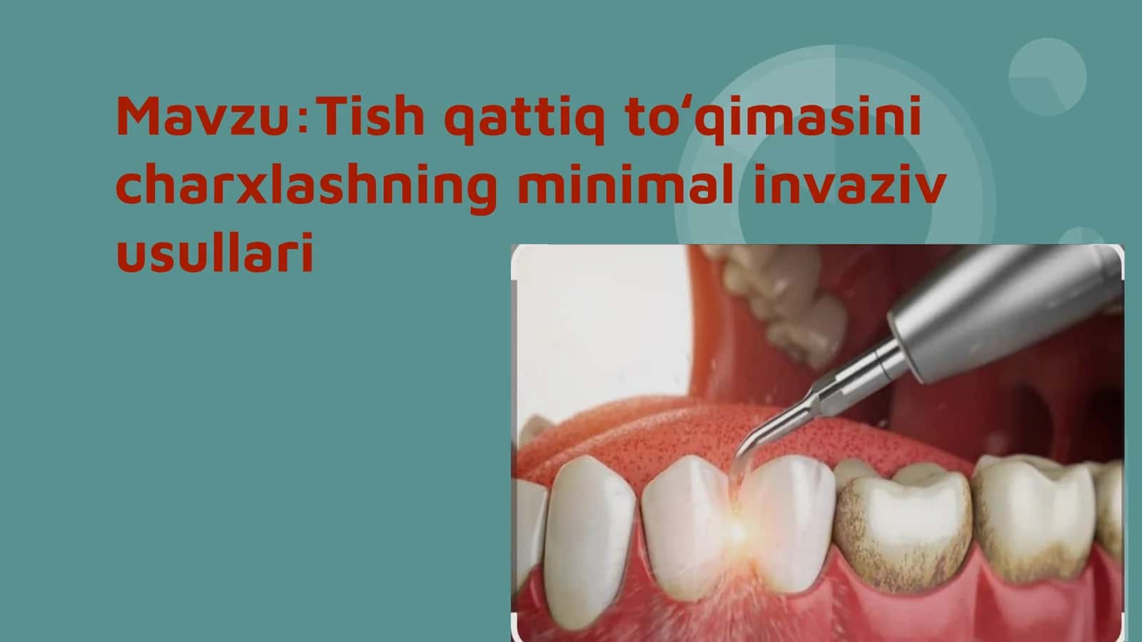 Tish qattiq toʻqimasini charxlashning minimal invaziv usullari 1