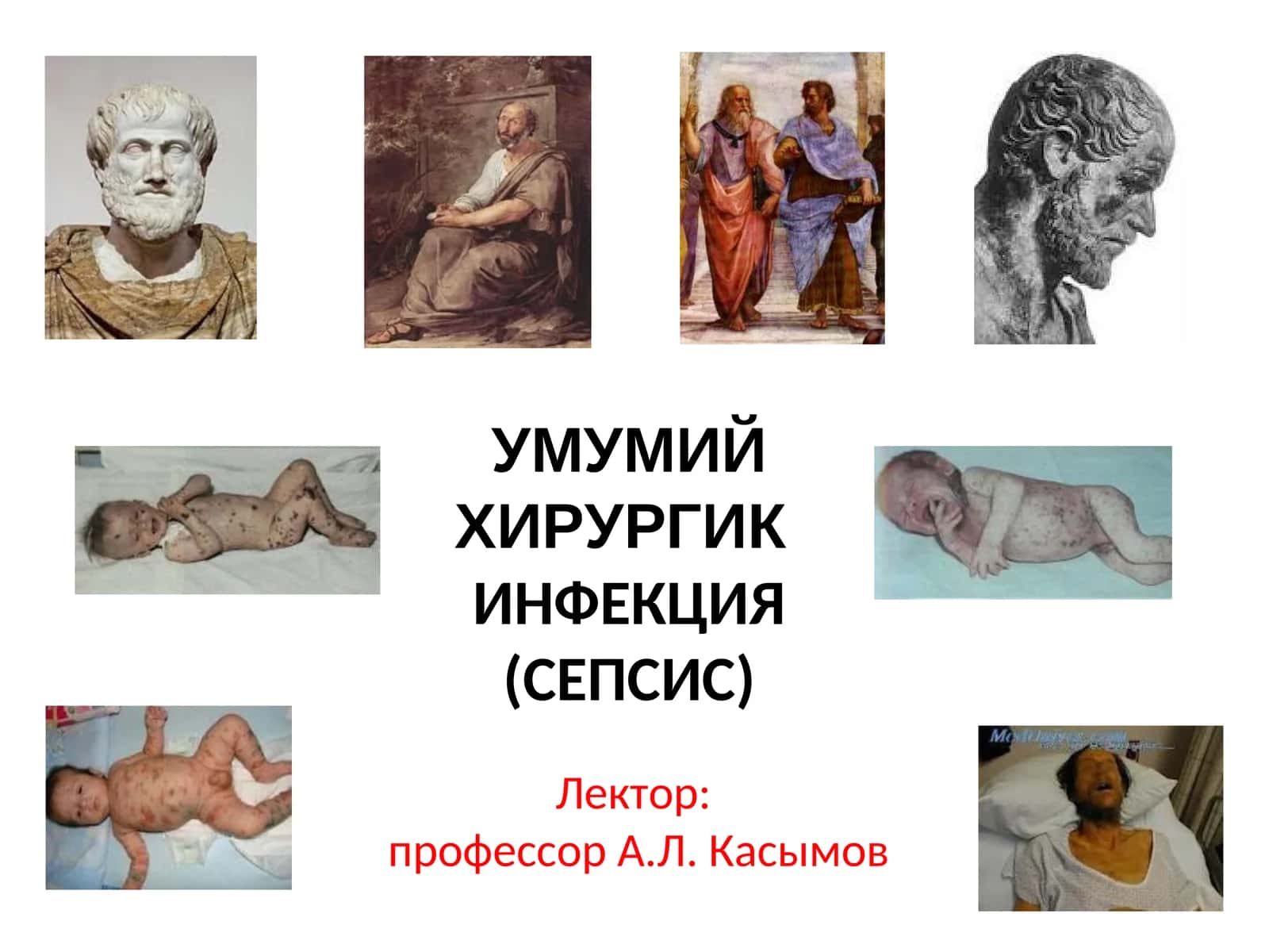 УМУМИЙ ХИРУРГИКИНФЕКЦИЯ (СЕПСИС) 1