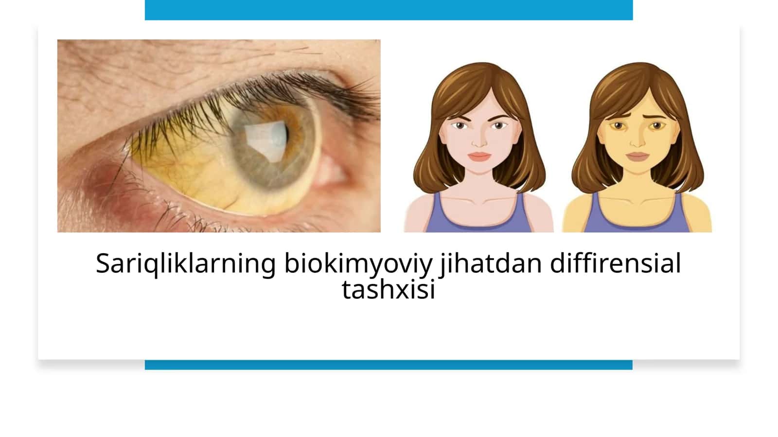 Sariqliklarning biokimyoviy jihatdan diffirensial tashxisi 1
