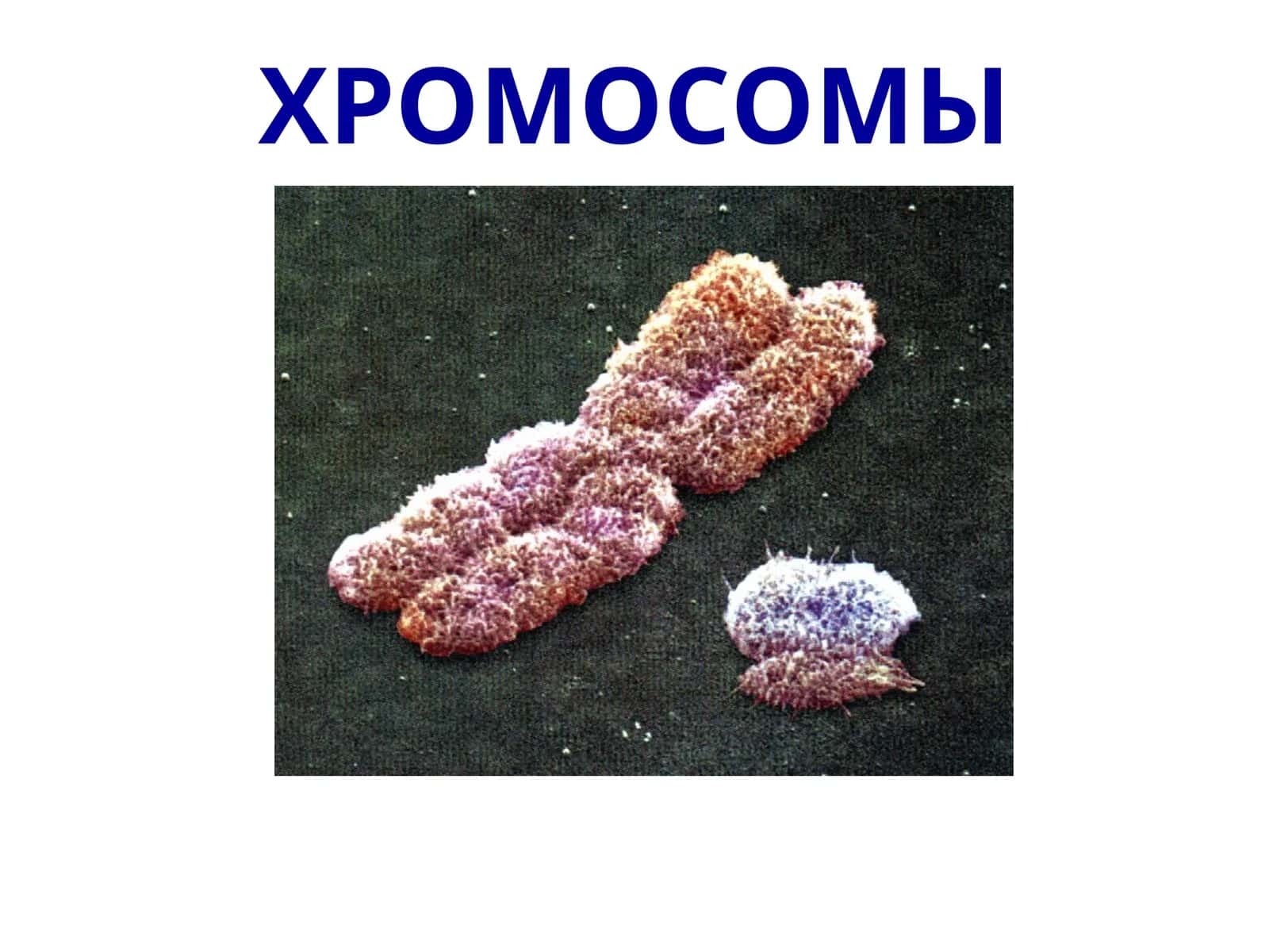 ХРОМОСОМЫ 1