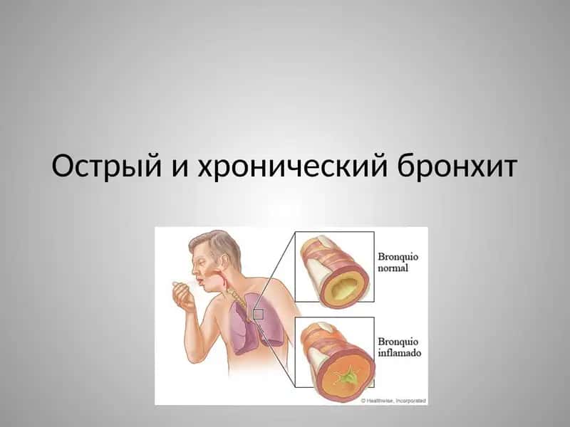 Острый и хронический бронхит 1