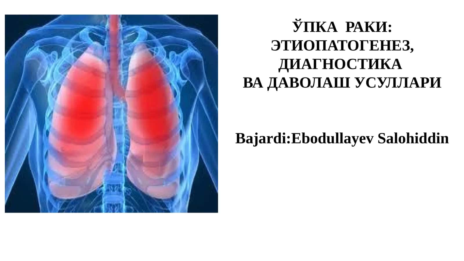 ЎПКА РАКИ: ЭТИОПАТОГЕНЕЗ, ДИАГНОСТИКА ВА ДАВОЛАШ УСУЛЛАРИ 1