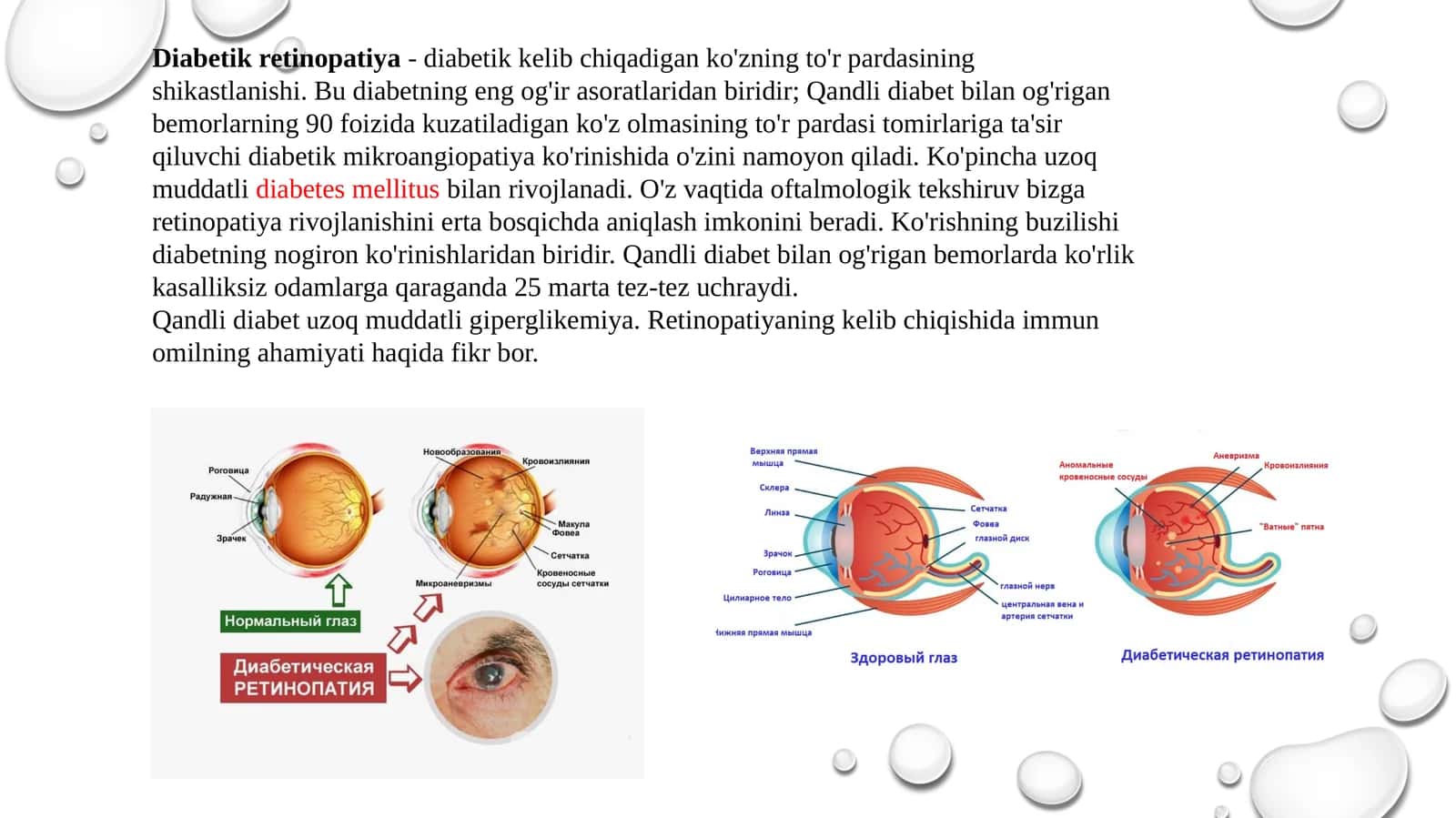 Diabetik retinopatiya 1