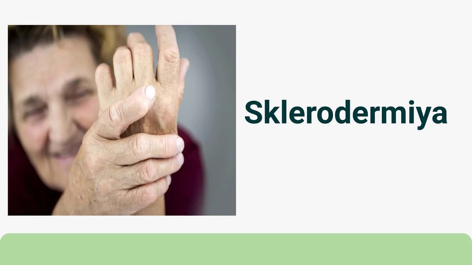 Sklerodermiya 1