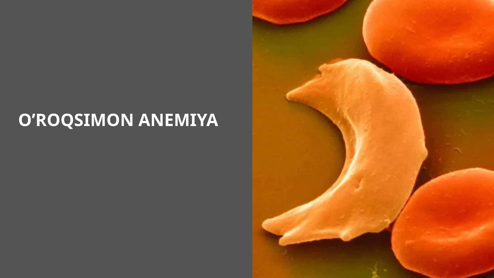 O’ROQSIMON ANEMIYA 1