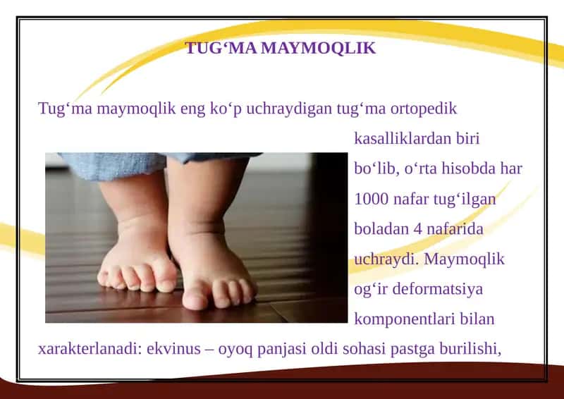 Tug‘ma maymoqlik 1