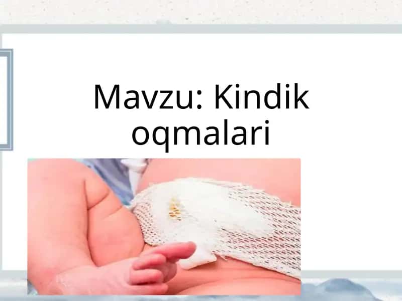 Kindik oqmalari 1