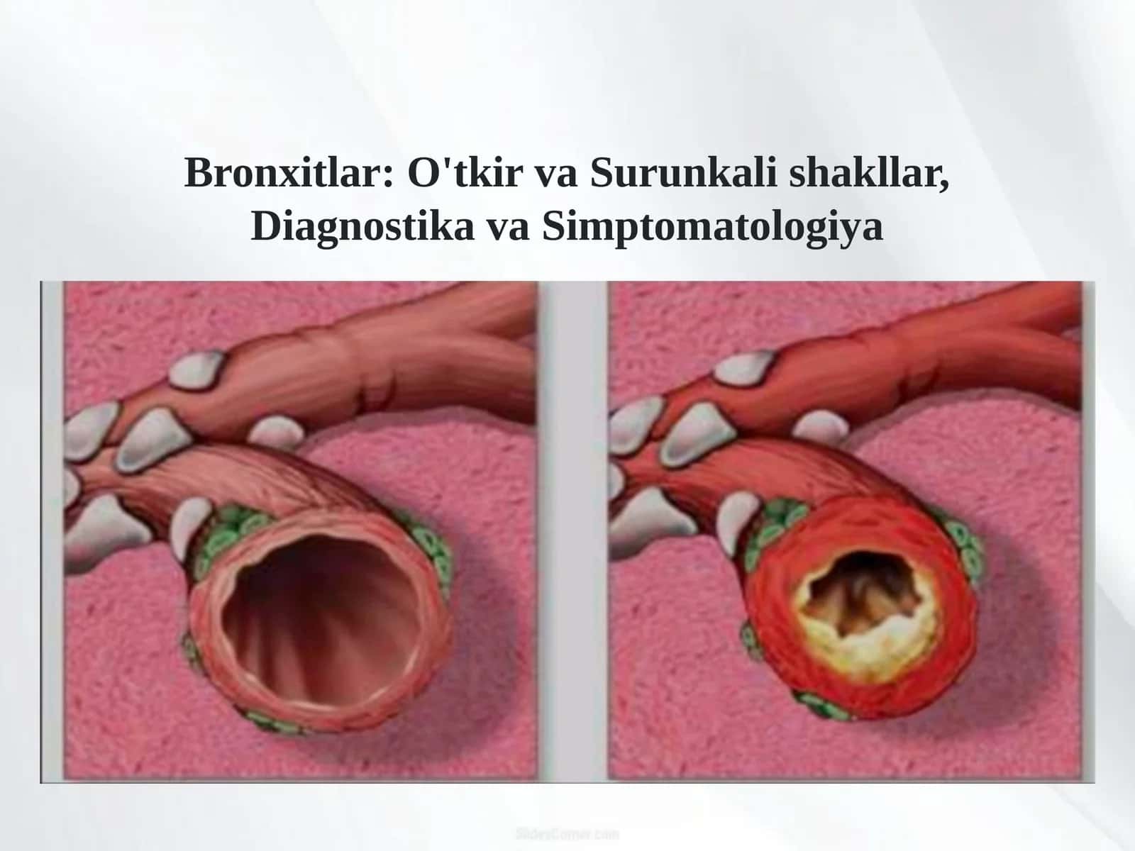 Bronxitlar: O'tkir va Surunkali shakllar, Diagnostika va Simptomatologiya 1