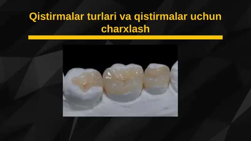 Qistirmalar turlari va qistirmalar uchun charxlash 1