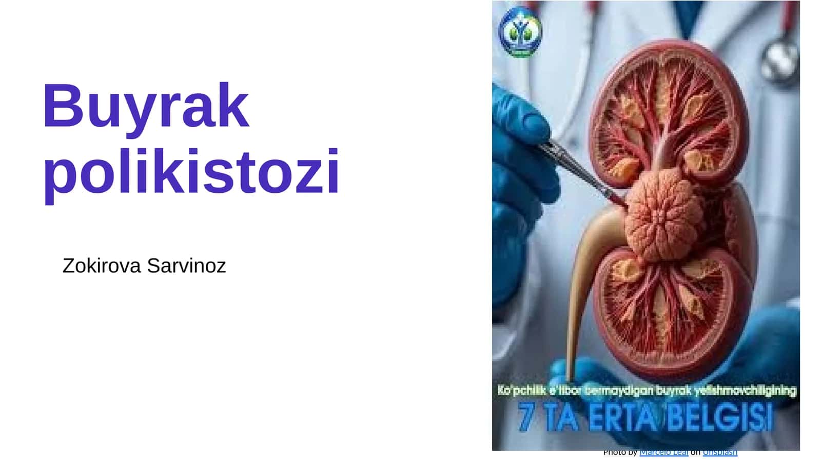 Buyrak polikistozi 1