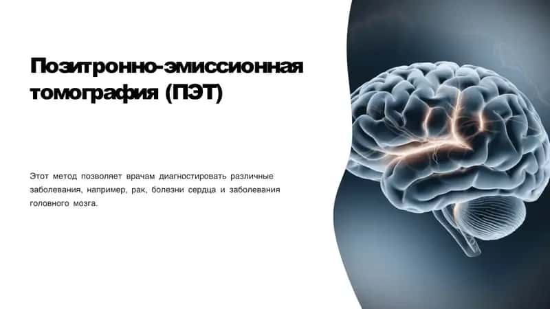 Позитронно-эмиссионная томография (ПЭТ) 1