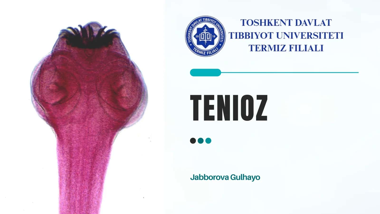 Tenioz 1