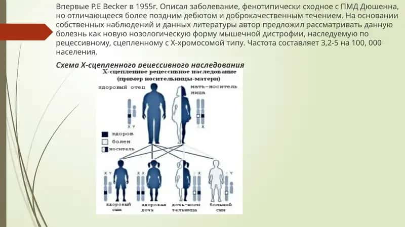 Прогрессирующая мышечная дистрофия Беккера 1