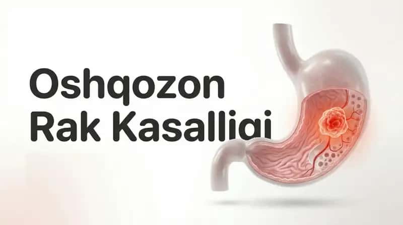 Oshqozon rak kasalligi 1