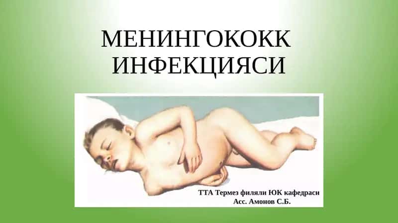 МЕНИНГОКОКК ИНФЕКЦИЯСИ 1