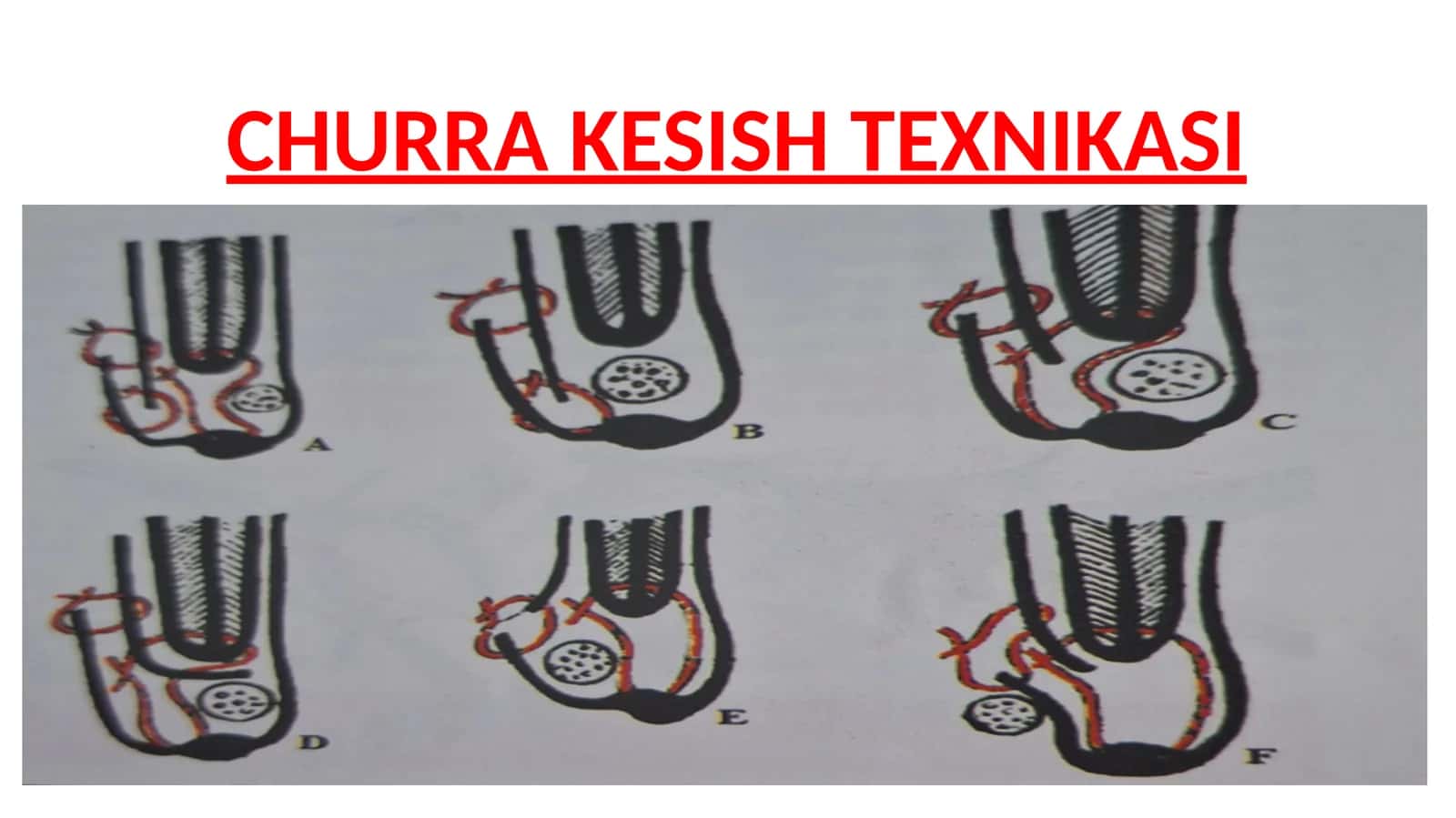 CHURRA KESISH TEXNIKASI 1