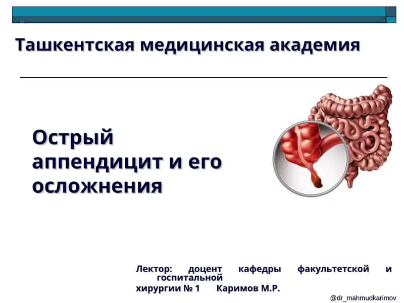 Острый аппендицит и его осложнения 1