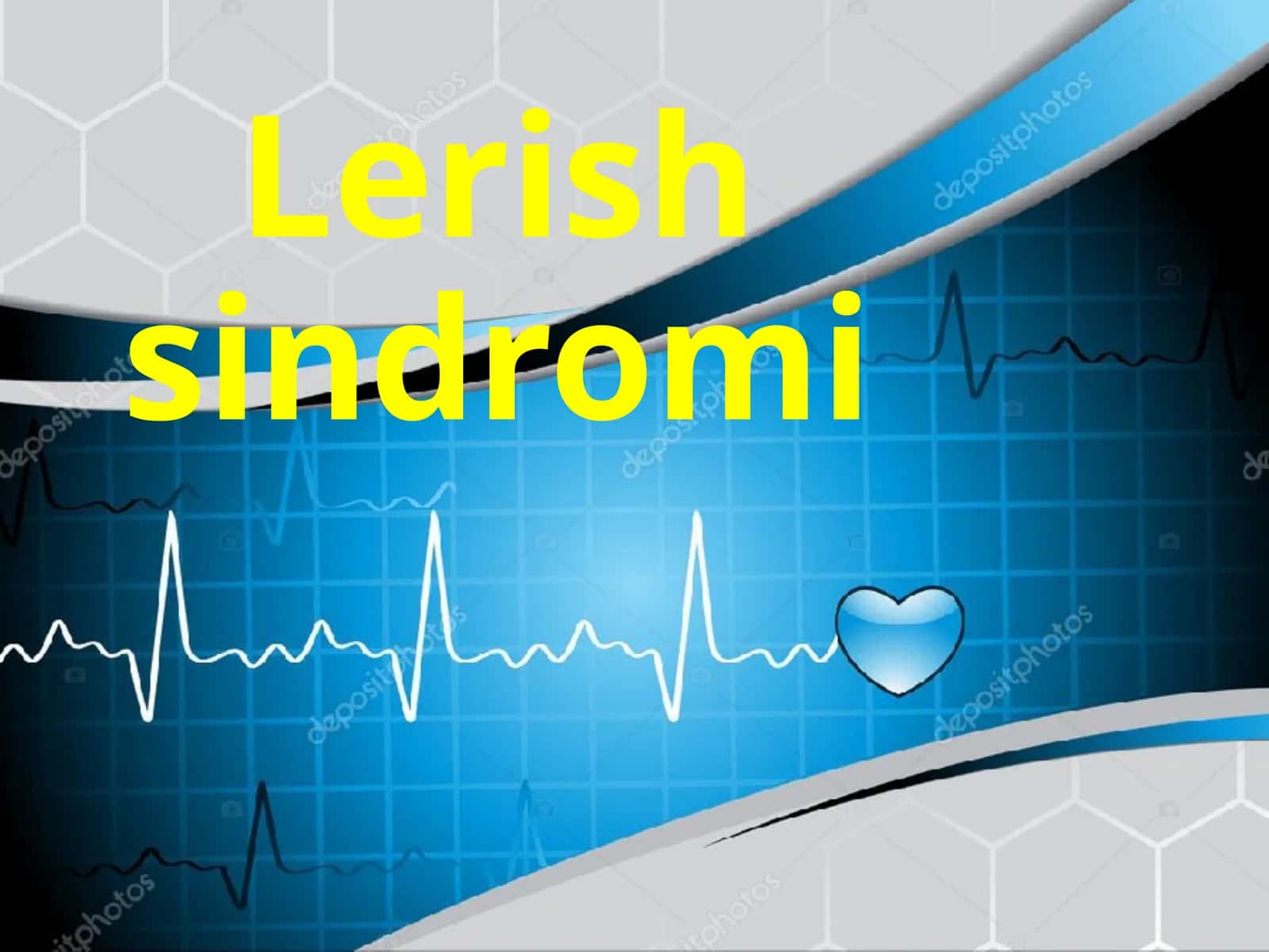 Lerishsindromi 1
