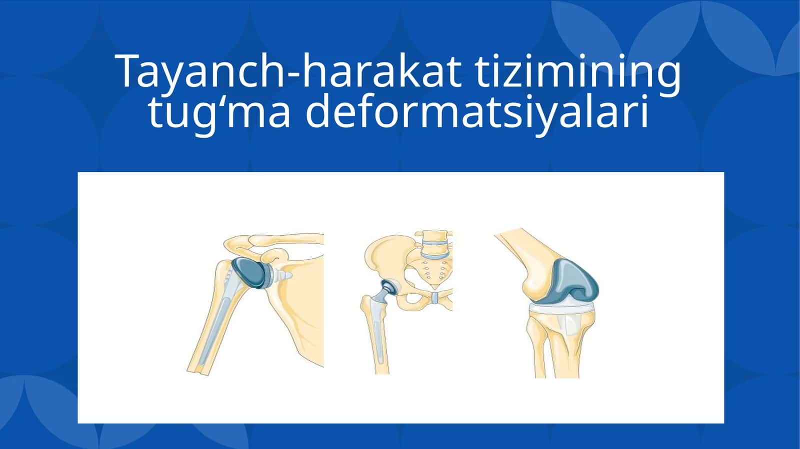 Tayanch-harakat tizimining tug‘ma deformatsiyalari 1