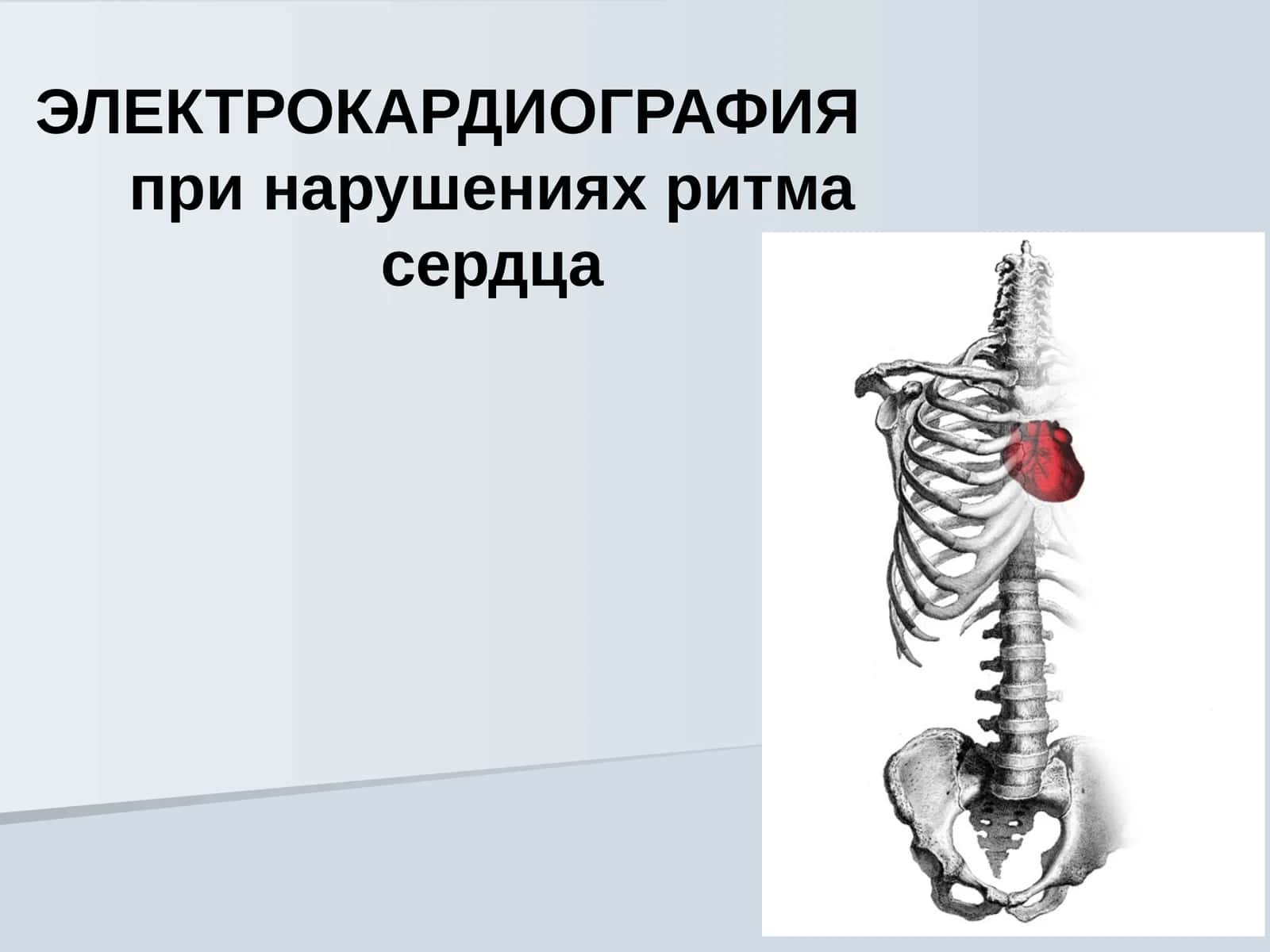ЭЛЕКТРОКАРДИОГРАФИЯ EKG 1