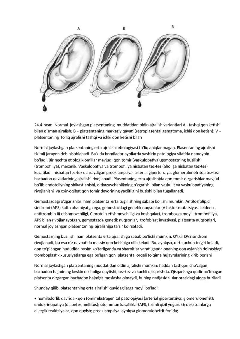 Platsenta ajralishi variantlari 1