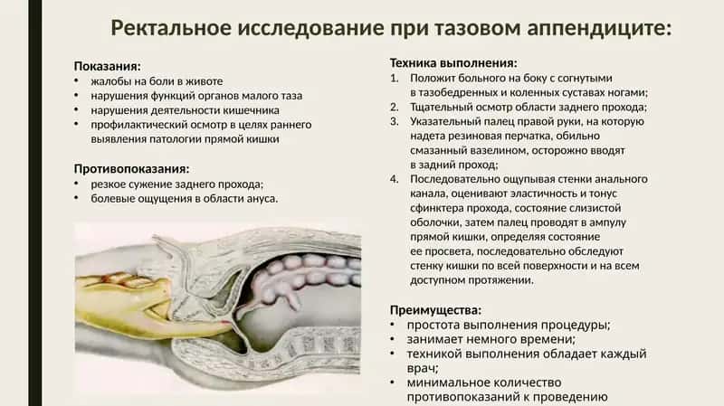 Ректальное исследование 1