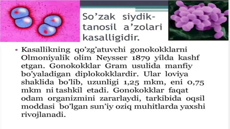 Soʻzak 1