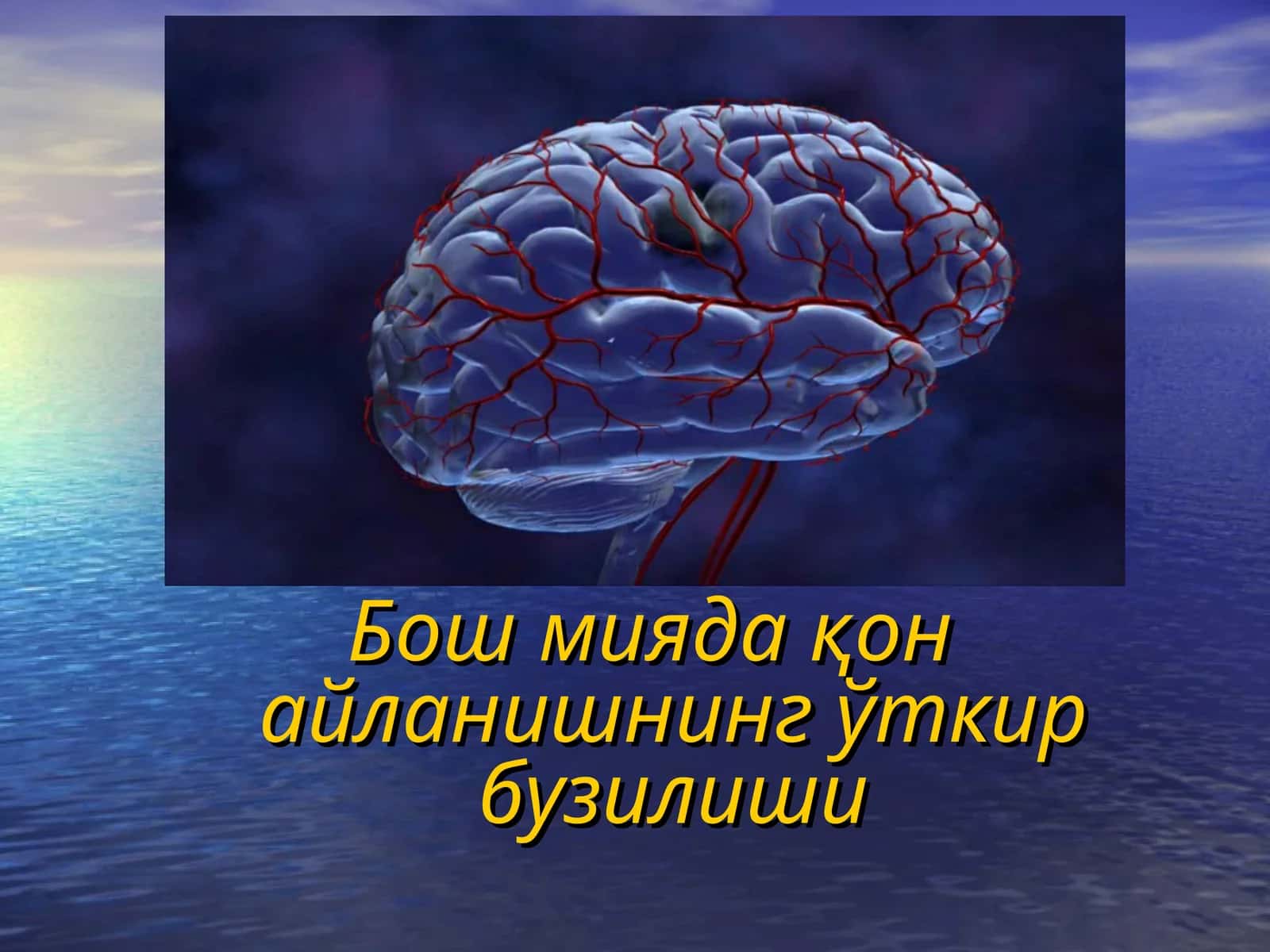 Бош миядақон айланишнинг ўткир бузилиши 1