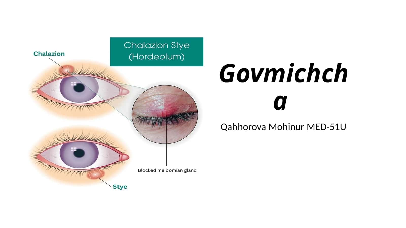 Govmichcha 1