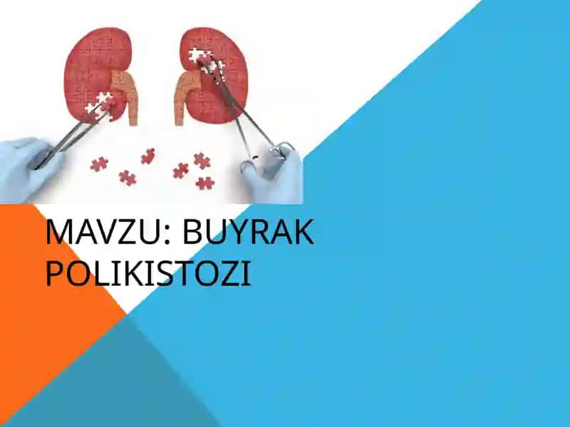 Buyrak polikistozi